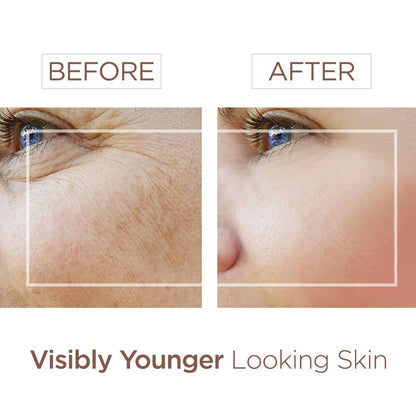 Bee & You Anti-Aging Face Serum with Bee Venom + Hyaluronic Acid
