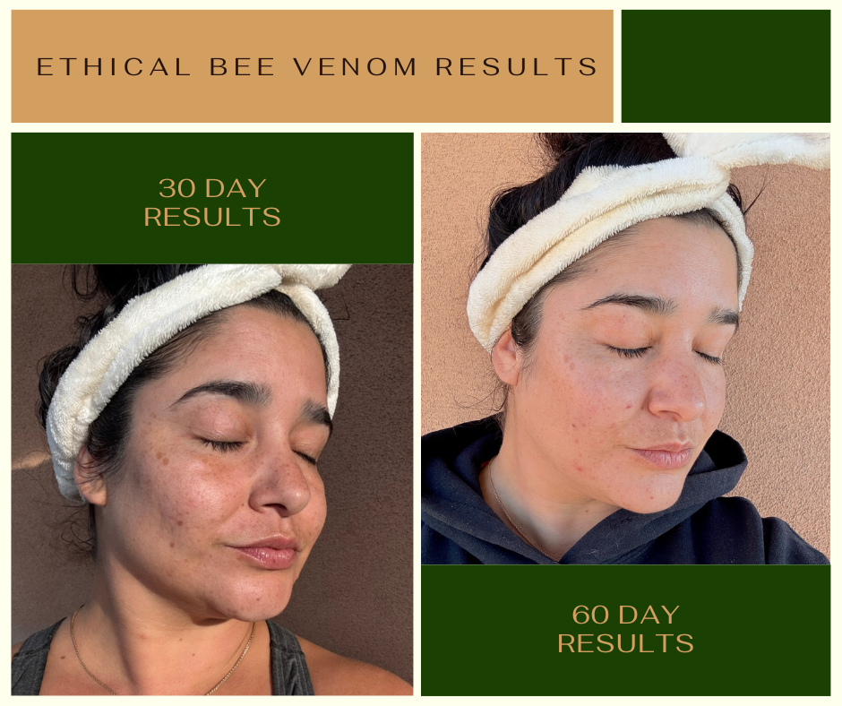 Alambique Bee Venom Skin Nectar